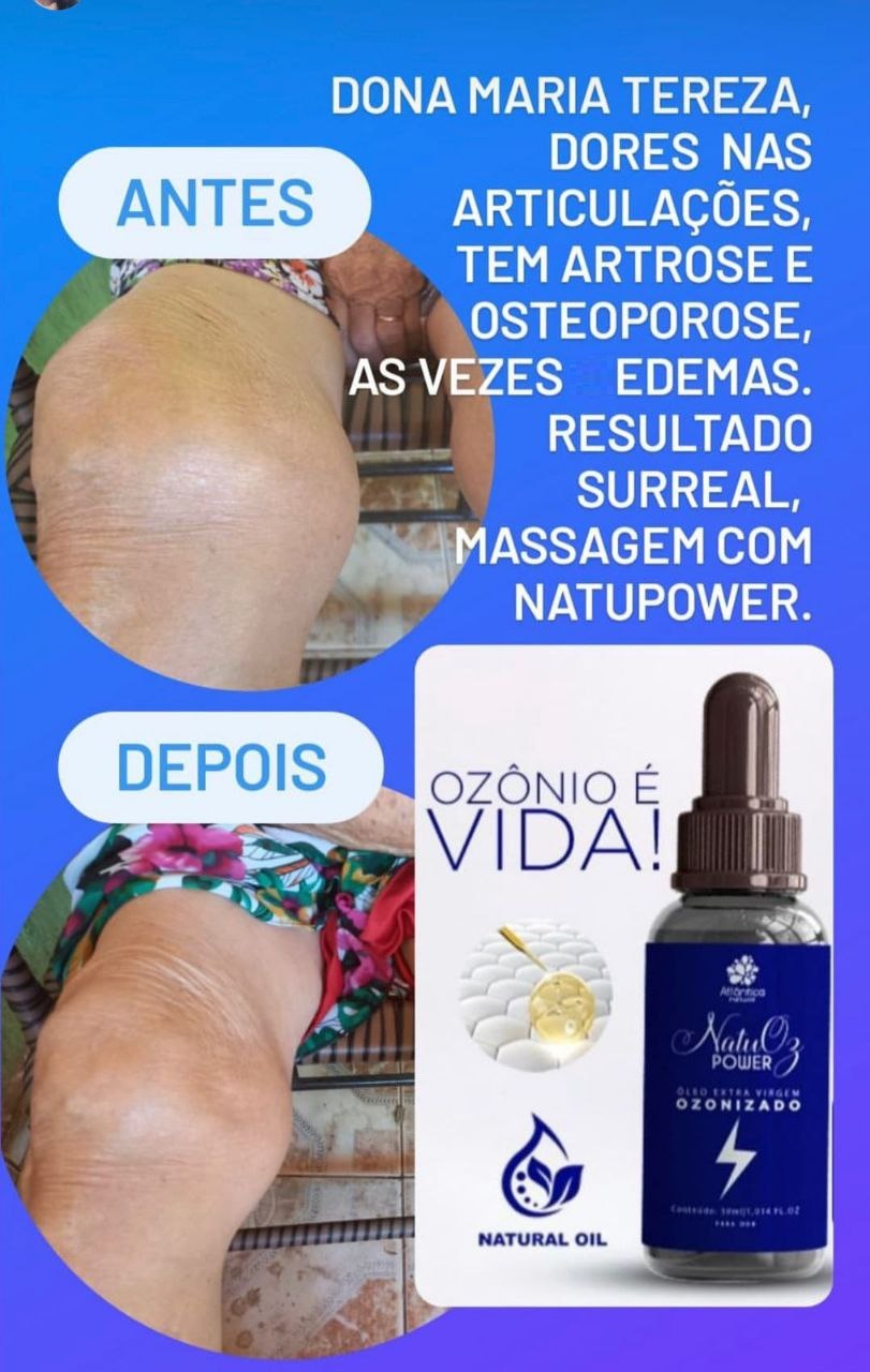 Antes e depois em articulação com edema
